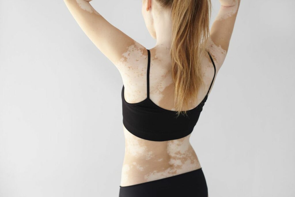 traitements_bigstock-people-lifestyle-health-der-272147734-1024x683